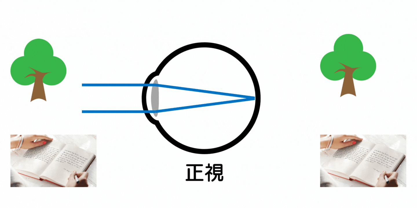 遠視×ビジョントレーニング-視力Aでも安心できない？！- | VT Base Fukuoka